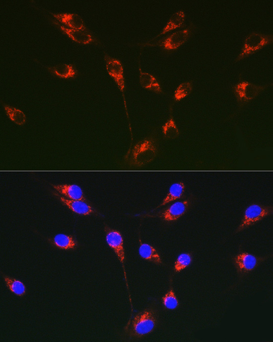 Immunofluorescence analysis of U-87MG cells using Tenascin C Polyclonal Antibody at dilution of 1:50 (40x lens). Blue: DAPI for nuclear staining.