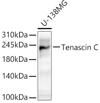 Western blot analysis of U-138MG using Tenascin C Polyclonal Antibody at 1:1000 dilution.