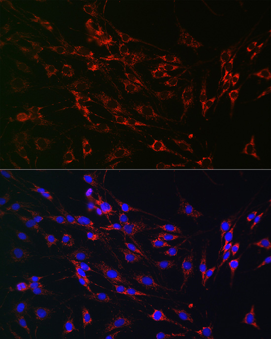 Immunofluorescence analysis of C6 cells using PMP70/PMP70/ABCD3 Polyclonal Antibody at dilution of 1:100 (40x lens). Blue: DAPI for nuclear staining.