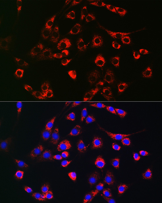 Immunofluorescence analysis of NIH-3T3 cells using PMP70/PMP70/ABCD3 Polyclonal Antibody at dilution of 1:100 (40x lens). Blue: DAPI for nuclear staining.