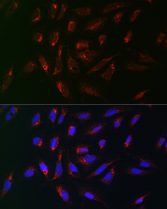 Immunofluorescence analysis of U2OS cells using PMP70/PMP70/ABCD3 Polyclonal Antibody at dilution of 1:100 (40x lens). Blue: DAPI for nuclear staining.