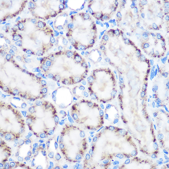 Immunohistochemistry of paraffin-embedded rat kidney using PMP70/ABCD3 Polyclonal Antibody at dilution of 1:100 (40x lens).Perform microwave antigen retrieval with 10 mM Tris/EDTA buffer pH 9.0 before commencing with IHC staining protocol.