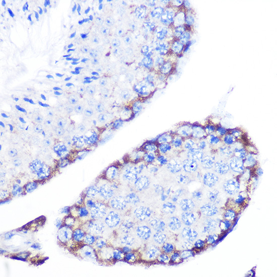 Immunohistochemistry of paraffin-embedded mouse testis using PMP70/ABCD3 Polyclonal Antibody at dilution of 1:100 (40x lens).Perform microwave antigen retrieval with 10 mM Tris/EDTA buffer pH 9.0 before commencing with IHC staining protocol.