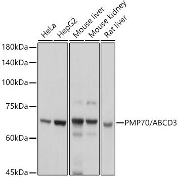Western blot analysis of extracts of various cell lines using PMP70/ABCD3 Polyclonal Antibody at 1:1000 dilution.