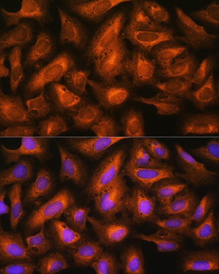 Immunofluorescence analysis of U2OS cells using EIF2B4 Polyclonal Antibody at dilution of 1:100. Blue: DAPI for nuclear staining.