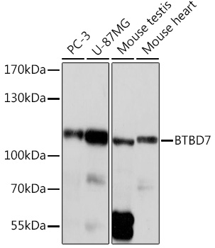 Western blot analysis of extracts of various cell lines using BTBD7 Polyclonal Antibody at1:1000 dilution.