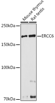 Western blot analysis of extracts of various cell lines using ERCC6 Polyclonal Antibody at 1:1000 dilution.