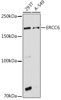 Western blot analysis of extracts of various cell lines using ERCC6 Polyclonal Antibody at 1:1000 dilution.