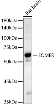 Western blot analysis of Rat brain using EOMES Polyclonal Antibody at 1:700 dilution.