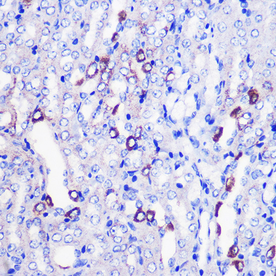 Immunohistochemistry of paraffin-embedded Mouse kidney using MRPL38 Polyclonal Antibody at dilution of 1:100 (40x lens).Perform microwave antigen retrieval with 10 mM PBS buffer pH 7.2 before commencing with IHC staining protocol.