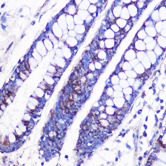 Immunohistochemistry of paraffin-embedded Human colon using MRPL38 Polyclonal Antibody at dilution of 1:100 (40x lens).Perform microwave antigen retrieval with 10 mM PBS buffer pH 7.2 before commencing with IHC staining protocol.