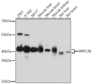 Western blot analysis of extracts of various cell lines using MRPL38 Polyclonal Antibody at 1:1000 dilution.