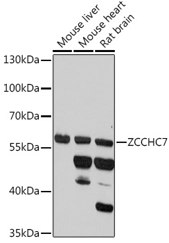 Western blot analysis of extracts of various cell lines using ZCCHC7 Polyclonal Antibody at 1:1000 dilution.