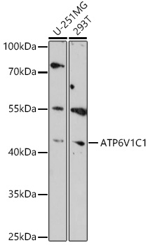 Western blot analysis of extracts of various cell lines using ATP6V1C1 Polyclonal Antibody at 1:1000 dilution.