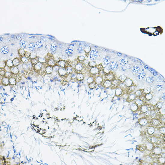 Immunohistochemistry of paraffin-embedded rat testis using Tulp2 Polyclonal Antibody at dilution of 1:200 (40x lens).Perform high pressure antigen retrieval with 10 mM citrate buffer pH 6.0 before commencing with IHC staining protocol.