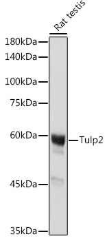 Western blot analysis of extracts of Rat testis using Tulp2 Polyclonal Antibody at 1:1000 dilution.