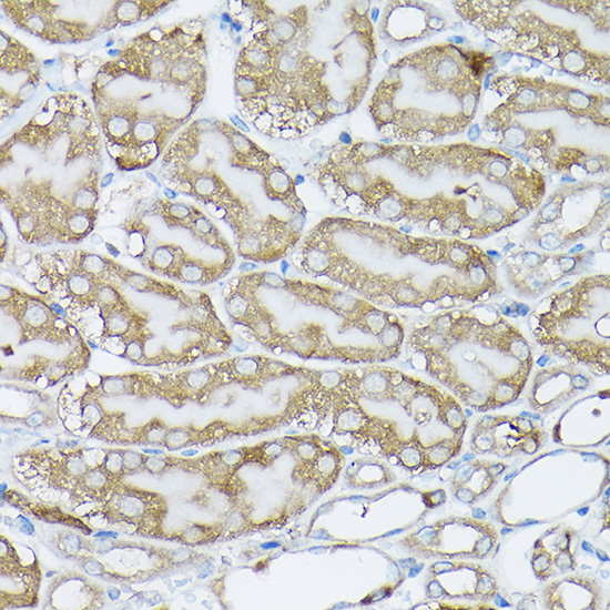 Immunohistochemistry of paraffin-embedded mouse kidney using BCAR1 Polyclonal Antibody at dilution of 1:50 (40x lens).Perform high pressure antigen retrieval with 10 mM citrate buffer pH 6.0 before commencing with IHC staining protocol.