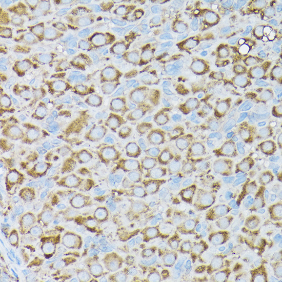 Immunohistochemistry of paraffin-embedded rat ovary using BCAR1 Polyclonal Antibody at dilution of 1:50 (40x lens).Perform high pressure antigen retrieval with 10 mM citrate buffer pH 6.0 before commencing with IHC staining protocol.