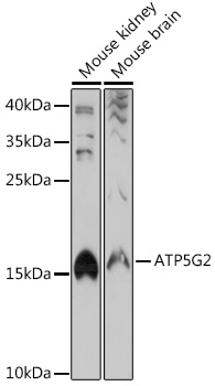 Western blot analysis of extracts of various cell lines using ATP5G2 Polyclonal Antibody at 1:1000 dilution.