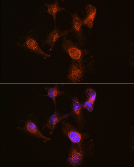 Immunofluorescence analysis of U-251 MG cells using ABCA7 Polyclonal Antibody at dilution of 1:100 (40x lens). Blue: DAPI for nuclear staining.