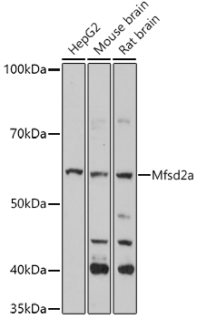 Western blot analysis of extracts of various cell lines using Mfsd2a Polyclonal Antibody at 1:1000 dilution.