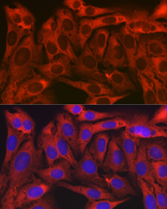 Immunofluorescence analysis of U2OS cells using TXLNA Polyclonal Antibody at dilution of 1:100 (40x lens). Blue: DAPI for nuclear staining.