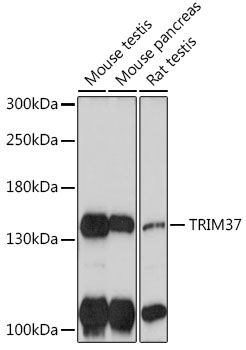 Western blot analysis of extracts of various cell lines using TRIM37 Polyclonal Antibody at 1:1000 dilution.