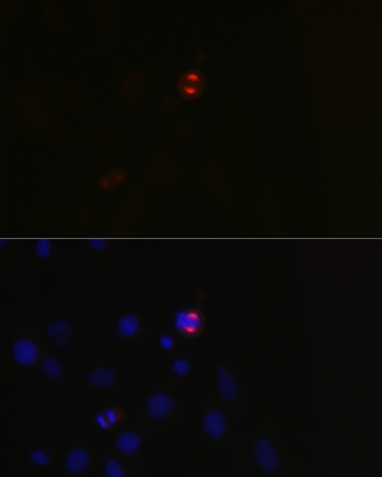 Immunofluorescence analysis of C6 cells using TPX2 Polyclonal Antibody at dilution of 1:100 (40x lens). Blue: DAPI for nuclear staining.