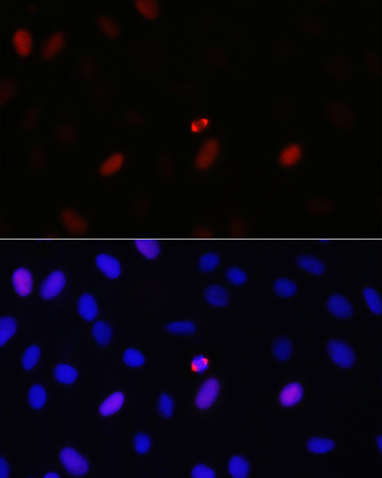 Immunofluorescence analysis of U2OS cells using TPX2 Polyclonal Antibody at dilution of 1:100 (40x lens). Blue: DAPI for nuclear staining.