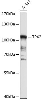 Western blot analysis of extracts of A-549 cells using TPX2 Polyclonal Antibody at 1:1000 dilution.