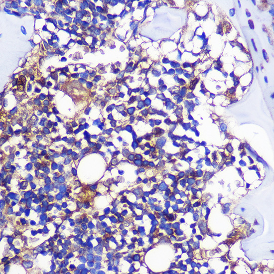 Immunohistochemistry of paraffin-embedded Rat leg bone using CCR1 Polyclonal Antibody at dilution of 1:100 (40x lens).Perform microwave antigen retrieval with 10 mM PBS buffer pH 7.2 before commencing with IHC staining protocol.