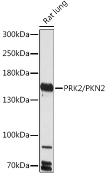 Western blot analysis of extracts of Rat lung using PRK2/PRK2/PKN2 Polyclonal Antibody at 1:1000 dilution.