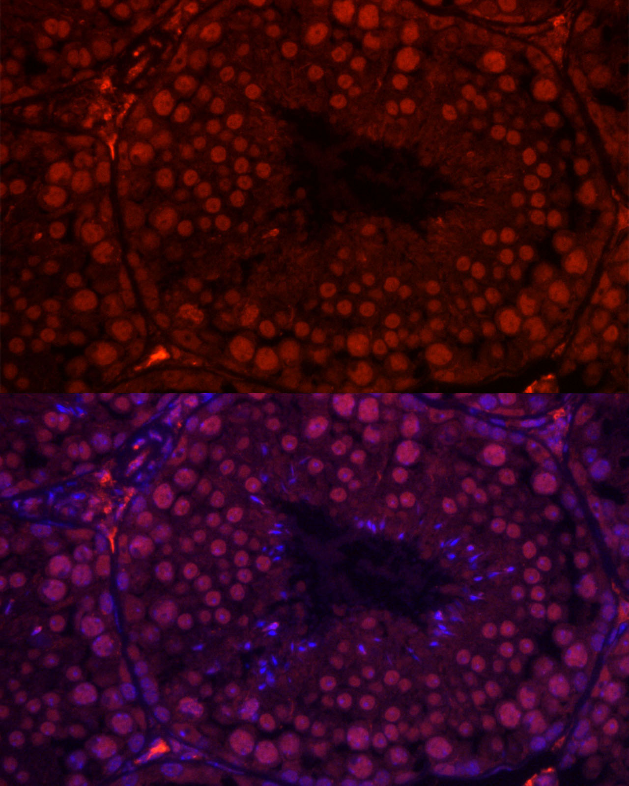 Immunofluorescence analysis of mouse testis cells using RBMY1A1 Polyclonal Antibody at dilution of 1:100 (40x lens). Blue: DAPI for nuclear staining.