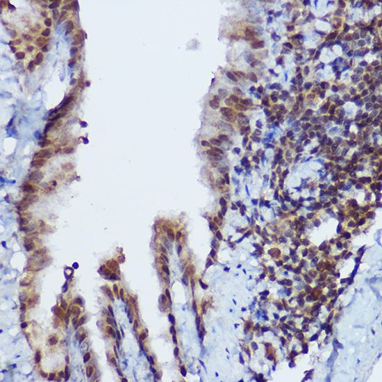 Immunohistochemistry of paraffin-embedded mouse lung using RBMY1A1 Polyclonal Antibody at dilution of 1:100 (40x lens).Perform high pressure antigen retrieval with 10 mM citrate buffer pH 6.0 before commencing with IHC staining protocol.