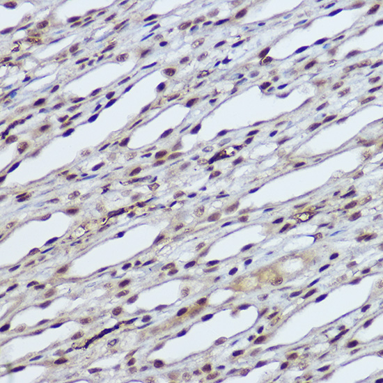 Immunohistochemistry of paraffin-embedded rat kidney using RBMY1A1 Polyclonal Antibody at dilution of 1:100 (40x lens).Perform high pressure antigen retrieval with 10 mM citrate buffer pH 6.0 before commencing with IHC staining protocol.