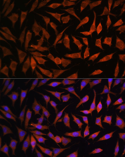 Immunofluorescence analysis of L929 cells using RPS8 Polyclonal Antibody at dilution of 1:100. Blue: DAPI for nuclear staining.