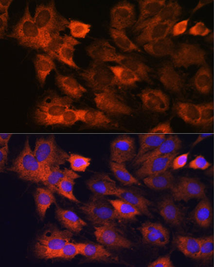 Immunofluorescence analysis of C6 cells using RPS8 Polyclonal Antibody at dilution of 1:100. Blue: DAPI for nuclear staining.