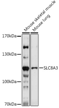 Western blot analysis of extracts of various cell lines using SLC8A3 Polyclonal Antibody at 1:1000 dilution.