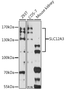 Western blot analysis of extracts of various cell lines using SLC12A3 Polyclonal Antibody at 1:3000 dilution.
