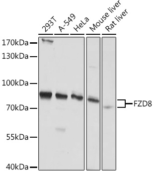 Western blot analysis of extracts of various cell lines using FZD8 Polyclonal Antibody at1:1000 dilution.