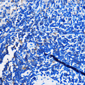 Immunohistochemistry of paraffin-embedded Rat spleen using HCAR3 Polyclonal Antibody at dilution of 1:100 (40x lens).Perform microwave antigen retrieval with 10 mM PBS buffer pH 7.2 before commencing with IHC staining protocol.