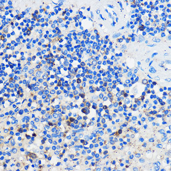 Immunohistochemistry of paraffin-embedded Human spleen using HCAR3 Polyclonal Antibody at dilution of 1:100 (40x lens).Perform microwave antigen retrieval with 10 mM PBS buffer pH 7.2 before commencing with IHC staining protocol.