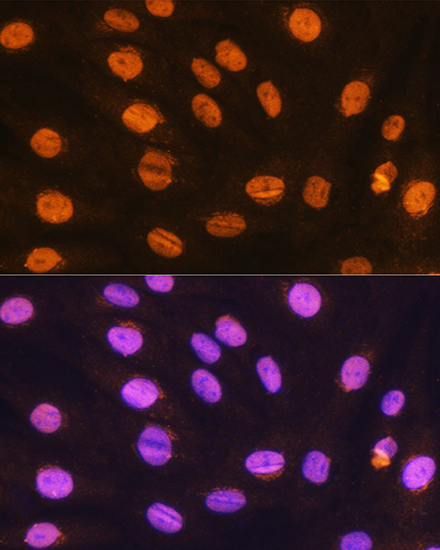 Immunofluorescence analysis of H9C2 cells using GTF3C3 Polyclonal Antibody at dilution of 1:100. Blue: DAPI for nuclear staining.