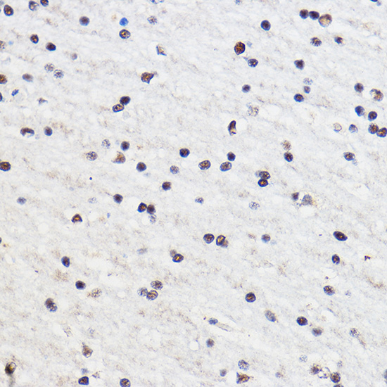 Immunohistochemistry of paraffin-embedded Rat brain using GTF3C3 Polyclonal Antibody at dilution of 1:100 (40x lens).Perform microwave antigen retrieval with 10 mM PBS buffer pH 7.2 before commencing with IHC staining protocol.