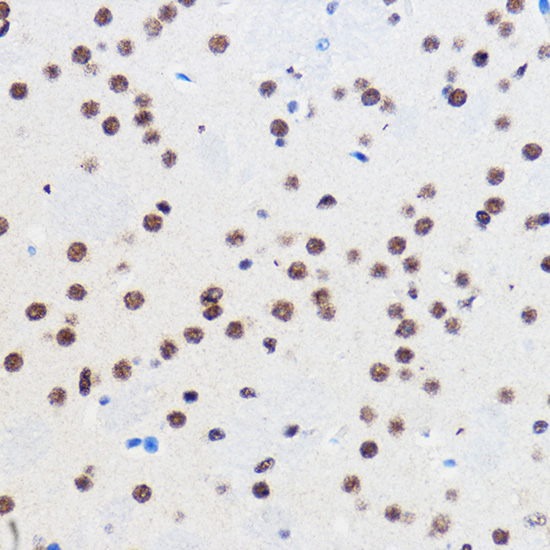 Immunohistochemistry of paraffin-embedded Mouse brain using GTF3C3 Polyclonal Antibody at dilution of 1:100 (40x lens).Perform microwave antigen retrieval with 10 mM PBS buffer pH 7.2 before commencing with IHC staining protocol.