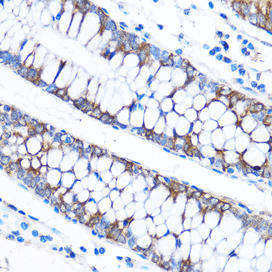 Immunohistochemistry of paraffin-embedded Human colon using CABP1 Polyclonal Antibody at dilution of 1:50 (40x lens).Perform microwave antigen retrieval with 10 mM PBS buffer pH 7.2 before commencing with IHC staining protocol.