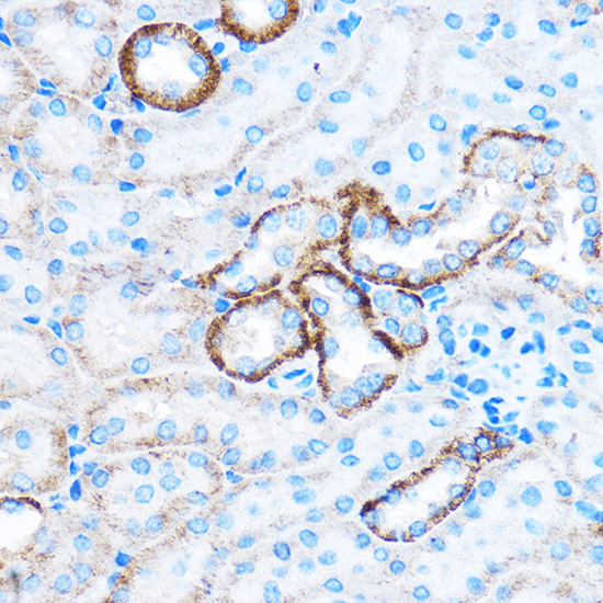 Immunohistochemistry of paraffin-embedded Mouse kidney using CABP1 Polyclonal Antibody at dilution of 1:50 (40x lens).Perform microwave antigen retrieval with 10 mM PBS buffer pH 7.2 before commencing with IHC staining protocol.