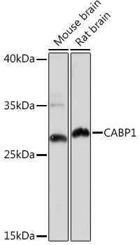 Western blot analysis of extracts of various cell lines using CABP1 Polyclonal Antibody at1:1000 dilution.