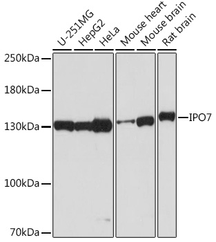 Western blot analysis of extracts of various cell lines using IPO7 Polyclonal Antibody at1:2000 dilution.