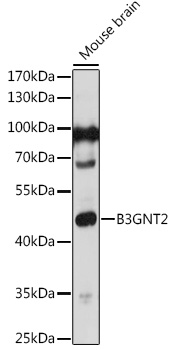 Western blot analysis of extracts of Mouse brain using B3GNT2 Polyclonal Antibody at 1:1000 dilution.